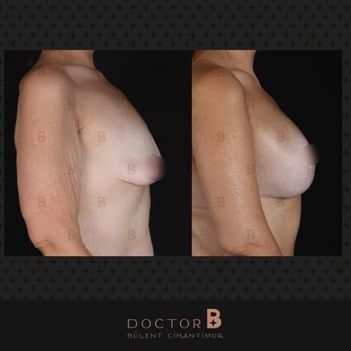 الجراحة التجميلية صور قبل وبعد
